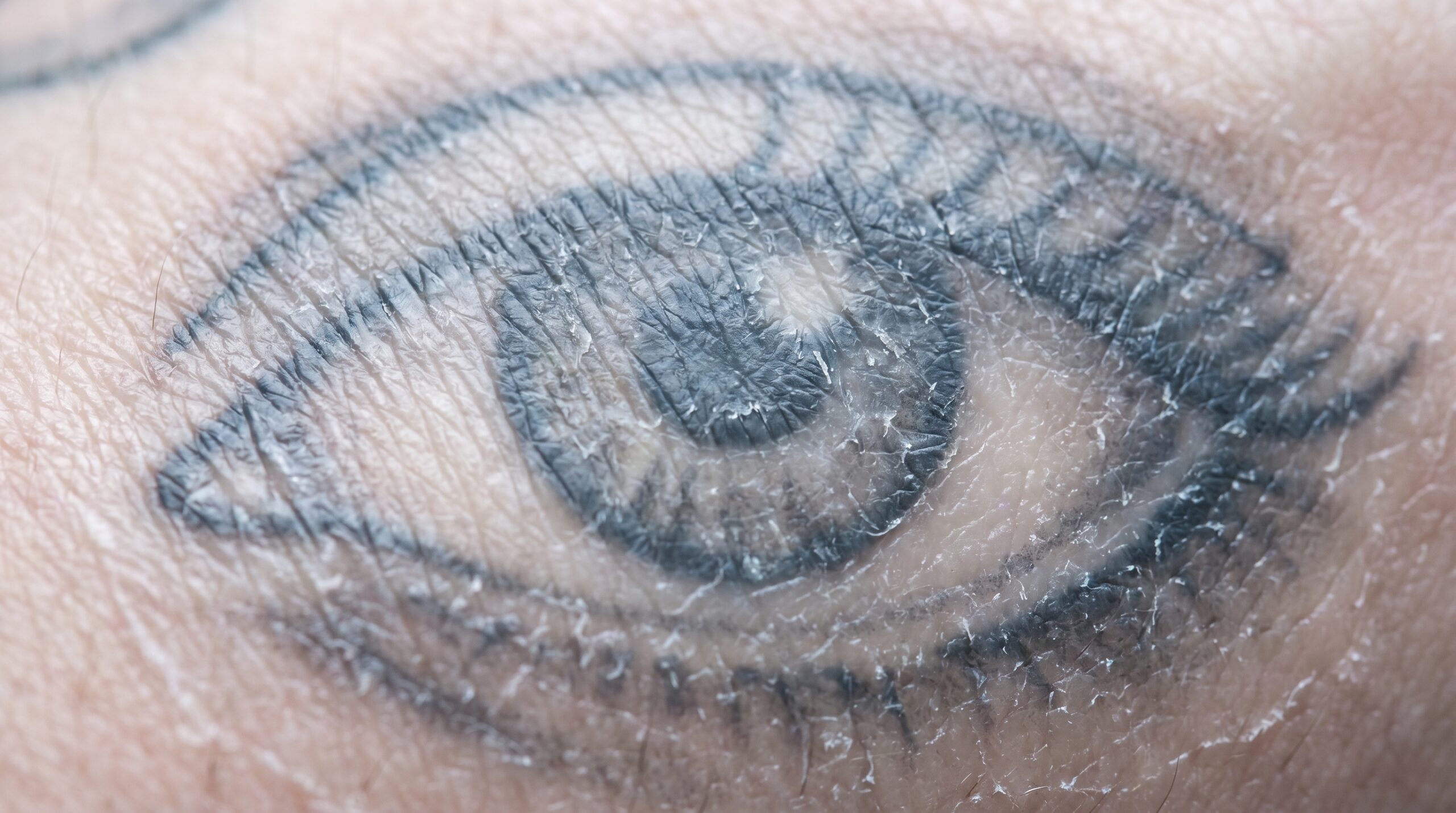 Macrografia estrema di pelle secca e desquamata in fase di guarigione, con una pellicola lattiginosa sopra un tatuaggio oculare dai toni grigio-neri tenui.